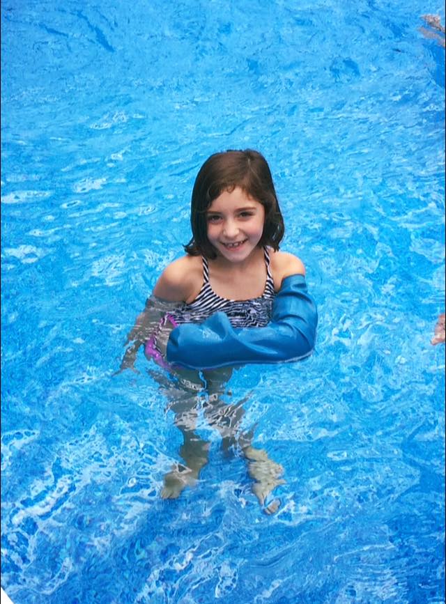Swimming with a broken arm