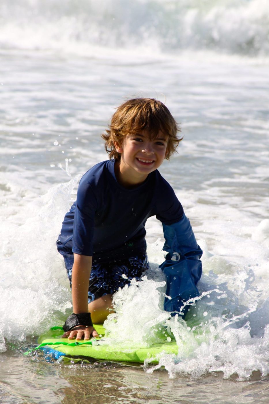 Enjoying summer with a broken arm