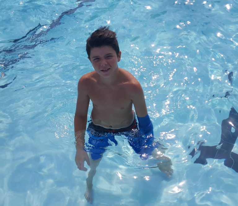 Swimming with a cast protector