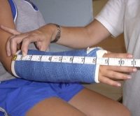 find size for cast cover